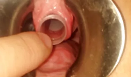 Schmerzen vor dem Sex deutsche private pornofilme